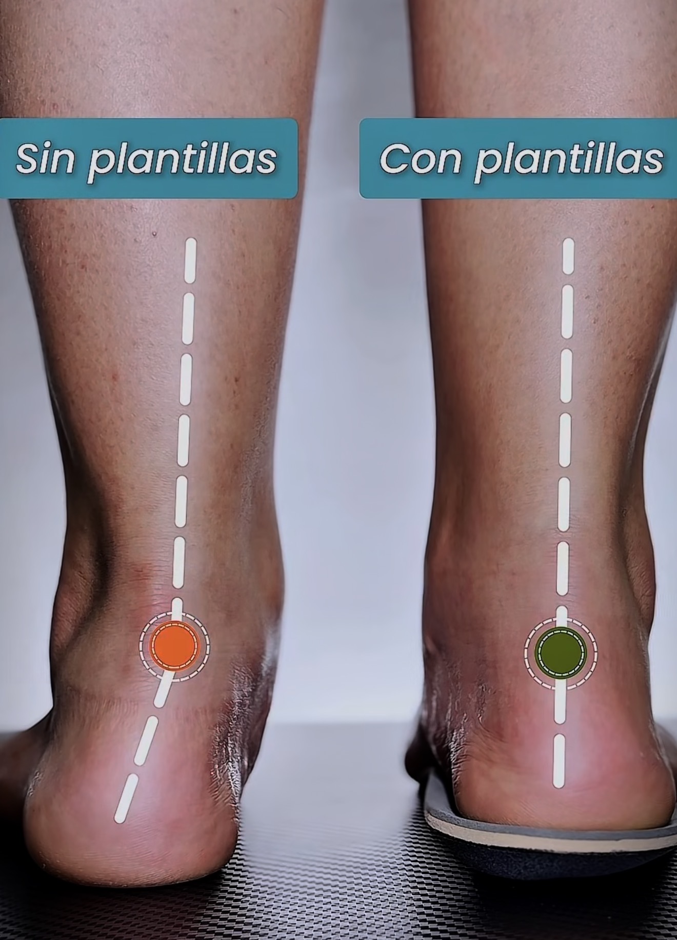 Plantillas a medida en Monte Grande